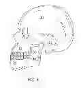 Fig. 03 - System and method for detecting deviations during the course of an orthodontic treatment to gradually reposition teeth