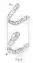 Fig. 05 - System and method for detecting deviations during the course of an orthodontic treatment to gradually reposition teeth