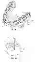 Fig. 02 - Methods and systems for treating teeth