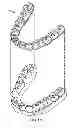 Fig. 03 - Methods and systems for treating teeth