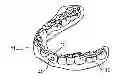 Fig. 01 - Tactile objects for orthodontics, systems and methods