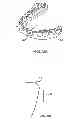 Fig. 04 - Tactile objects for orthodontics, systems and methods