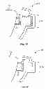 Fig. 07 - Tactile objects for orthodontics, systems and methods