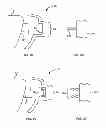 Fig. 08 - Tactile objects for orthodontics, systems and methods