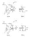 Fig. 09 - Tactile objects for orthodontics, systems and methods