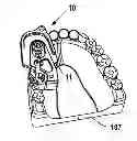 Fig. 01 - Multi-Axial Positioning Dental Drill Guide Assembly