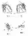 Fig. 02 - Multi-Axial Positioning Dental Drill Guide Assembly