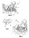 Fig. 03 - Multi-Axial Positioning Dental Drill Guide Assembly