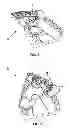 Fig. 04 - Multi-Axial Positioning Dental Drill Guide Assembly