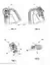 Fig. 02 - Dental Osteotomy Appliance and Preparation Method