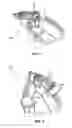 Fig. 04 - Dental Osteotomy Appliance and Preparation Method