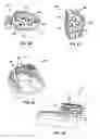 Fig. 12 - Dental Osteotomy Appliance and Preparation Method