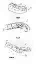 Fig. 02 - Surgical guide system for dental implantology and method for making the same