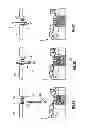 Fig. 06 - Surgical guide system for dental implantology and method for making the same