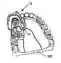 Fig. 01 - Dental Drill Platform with Adjustable Drill Bushing