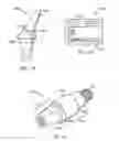 Fig. 14 - Components for use with implants and related methods