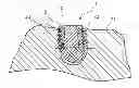 Fig. 01 - Body made of bone substitute material and method for production