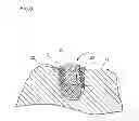 Fig. 05 - Body made of bone substitute material and method for production
