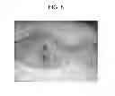 Fig. 09 - Cyclic implant perfusion, cleaning and passivation process and implant produced thereby