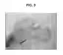 Fig. 10 - Cyclic implant perfusion, cleaning and passivation process and implant produced thereby
