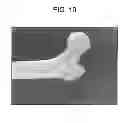 Fig. 11 - Cyclic implant perfusion, cleaning and passivation process and implant produced thereby