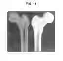 Fig. 12 - Cyclic implant perfusion, cleaning and passivation process and implant produced thereby