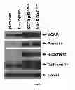 Fig. 04 - Culture Based Screening Assay and Methods of Use Thereof to Identify Agents Which Modulate Tumor Development, Invasion and Differentiation