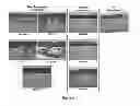 Fig. 07 - Culture Based Screening Assay and Methods of Use Thereof to Identify Agents Which Modulate Tumor Development, Invasion and Differentiation