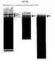 Fig. 20 - Culture Based Screening Assay and Methods of Use Thereof to Identify Agents Which Modulate Tumor Development, Invasion and Differentiation