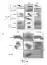 Fig. 05 - Isolation and detection of cancer cells