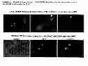 Fig. 03 - Cell-based detection of APF through its interaction with CKAP4 for diagnosis of interstitial cystitis