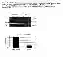 Fig. 05 - Cell-based detection of APF through its interaction with CKAP4 for diagnosis of interstitial cystitis