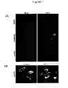 Fig. 08 - Cell-based detection of APF through its interaction with CKAP4 for diagnosis of interstitial cystitis