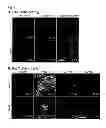 Fig. 02 - Markers for dopaminergic neuron progenitor cells