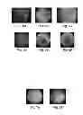 Fig. 05 - CHROMATOGRAPHY FILTER PAPER-BASED ELISA