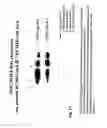Fig. 18 - Biomarkers for ankylosing spondylitis
