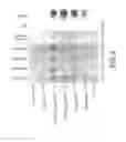 Fig. 10 - Methods and compositions for determining the purity of chemically synthesized nucleic acids