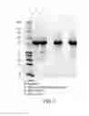 Fig. 02 - METHODS OF PURIFICATION OF NATIVE OR MUTANT FORMS OF DIPHTHERIA TOXIN