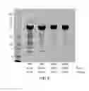 Fig. 05 - METHODS OF PURIFICATION OF NATIVE OR MUTANT FORMS OF DIPHTHERIA TOXIN