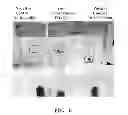 Fig. 07 - STEADY STATE ANAEROBIC DENITRIFYING CONSORTIUM FOR APPLICATION IN IN-SITU BIOREMEDIATION OF HYDROCARBON-CONTAMINATED SITES AND ENHANCED OIL RECOVERY