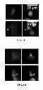 Fig. 04 - IMAGE ANALYSIS AND MEASUREMENT OF BIOLOGICAL SAMPLES