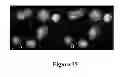 Fig. 25 - IMAGE ANALYSIS AND MEASUREMENT OF BIOLOGICAL SAMPLES