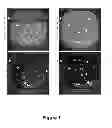 Fig. 08 - DEVICE FOR WASHING SUSPENDED CELLS OR PARTICLES