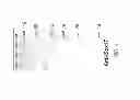 Fig. 05 - PDX1 EXPRESSING ENDODERM