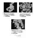 Fig. 197 - Microcarriers for stem cell culture