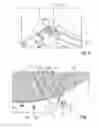 Fig. 06 - Threshing mechanism with swivellable concaves