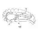 Fig. 06 - Blade constructs and methods of forming blade constructs