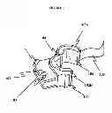 Fig. 02 - ExerThighzer