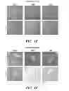 Fig. 05 - Ovarian cancer stem cells and methods of isolation and uses thereof