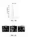 Fig. 19 - Ovarian cancer stem cells and methods of isolation and uses thereof